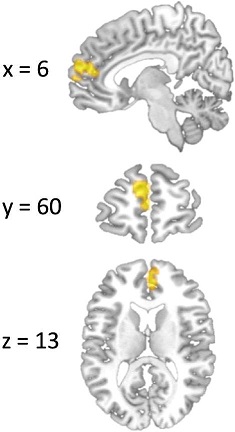 246115.fig.003a